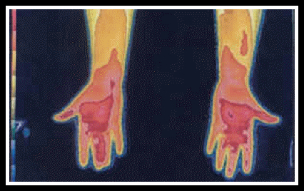 OJ Hands Thermo2 OJ Hands Thermo2