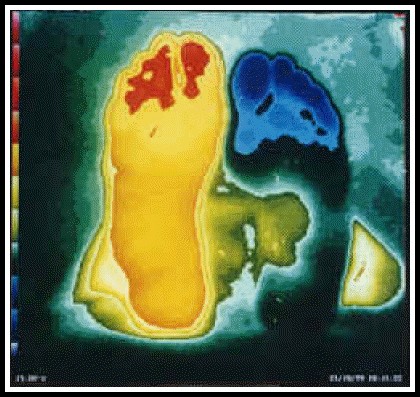 db_RSD__Neuroma_Exploration_Thermo_copy1a db_RSD__Neuroma_Exploration_Thermo_copy1a